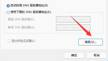 Win11如何修改tcp协议?