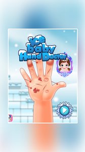 冰雪宝贝手部治疗截图