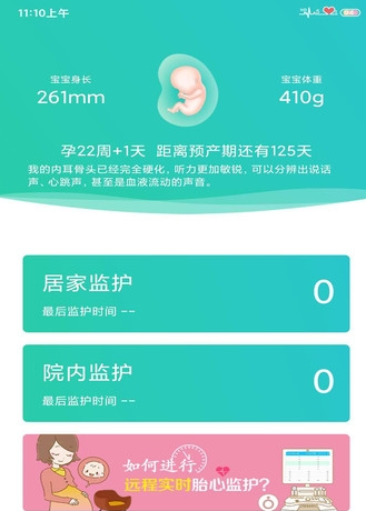 胎心监护截图