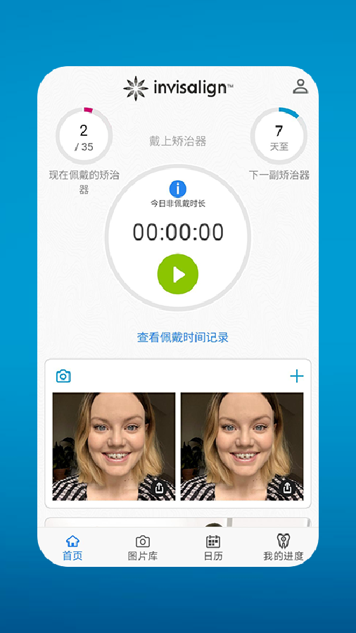 My Invisalign My Invisalign截图