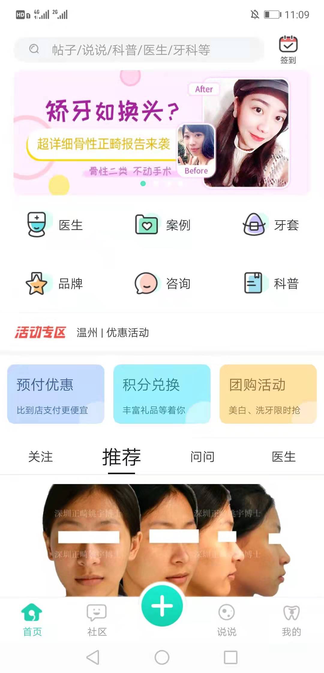 牙套之家 牙套之家截图