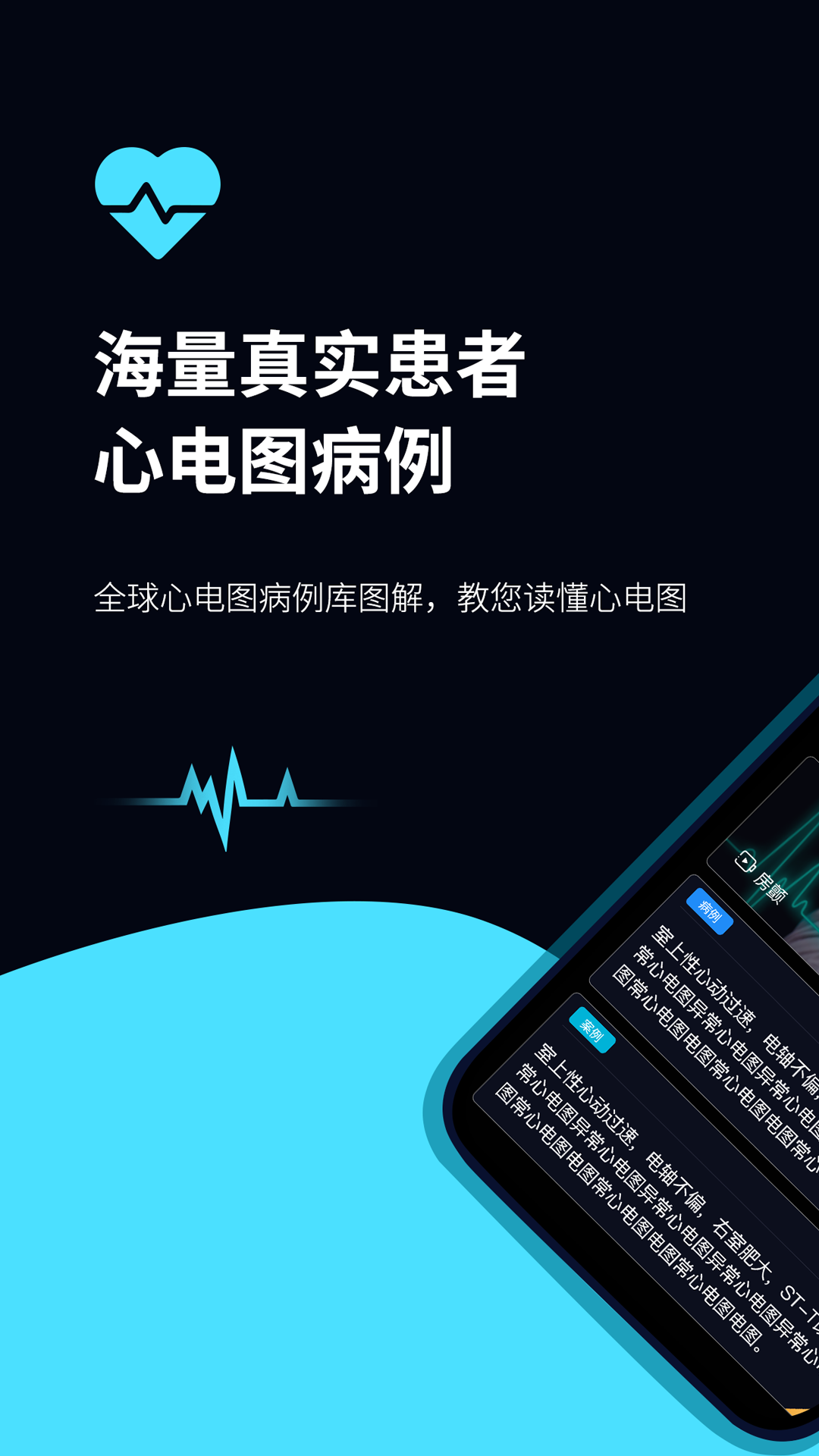 心电图ECG 心电图ECG截图
